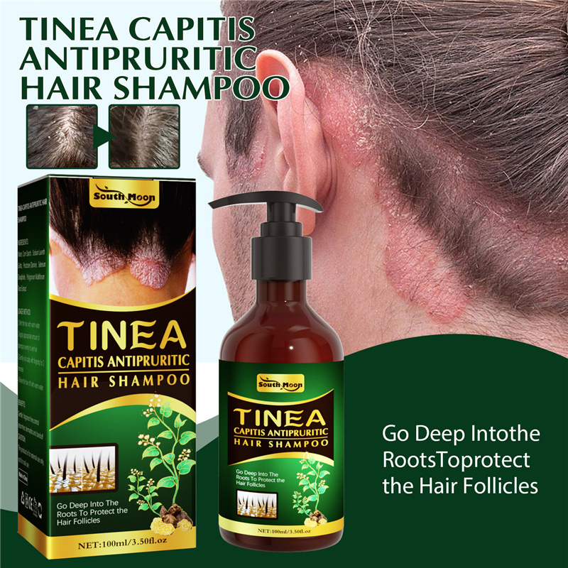 South Moon tinea capitis anti pruritic hair shampoo seborrheic dermatitis psoriasis itch relieving dandruff removing shampoo