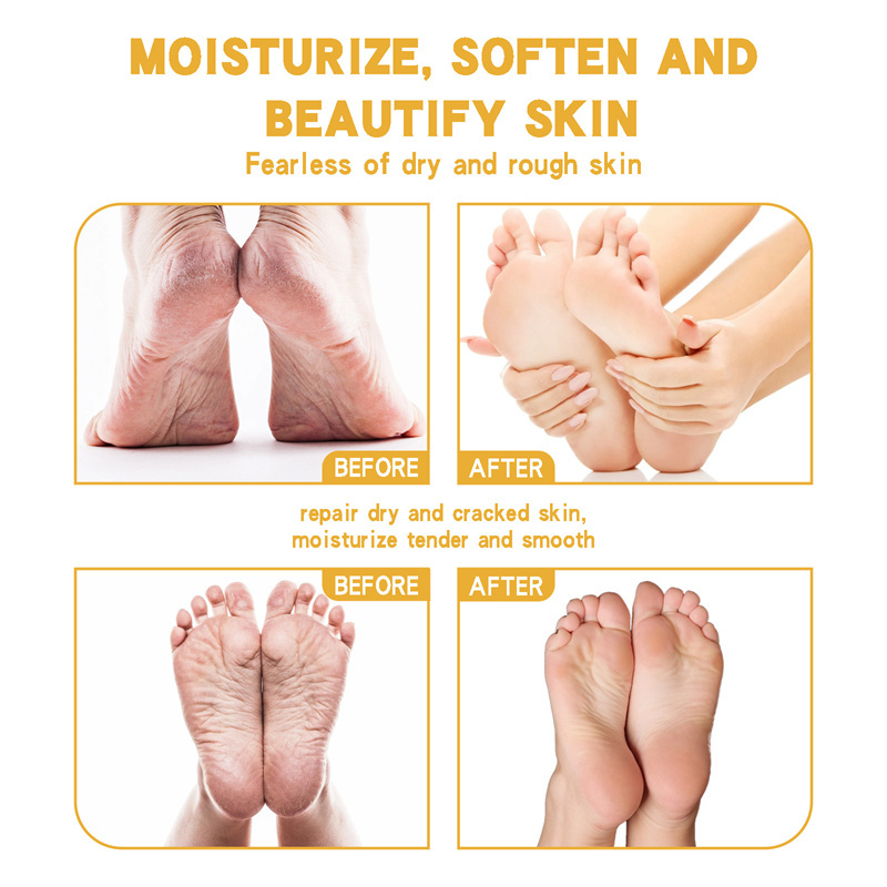 EELHOE 20g soothing chapping cream moisturizing softening smoothing anti crack foot cream