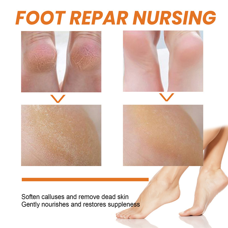 South Moon 30ml foot callus removal spray moisturizing exfoliating softening smoothing callus removing spray for feet