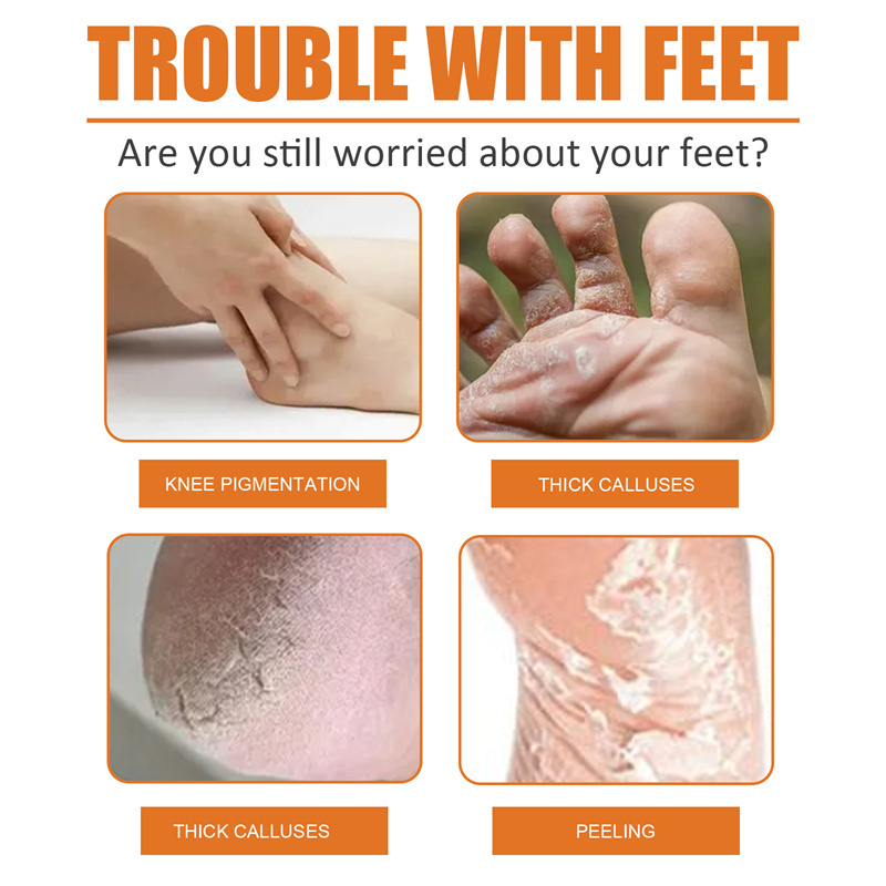 South Moon 30ml foot callus removal spray moisturizing exfoliating softening smoothing callus removing spray for feet