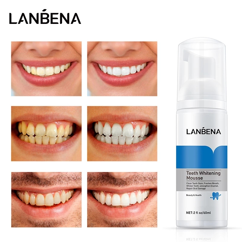 LANBENA Teeth Whitening Mousse Tooth Whitening Cleaning White Teeth Oral Hygiene Toothpaste Bleaching Remove Stains Dental Tool