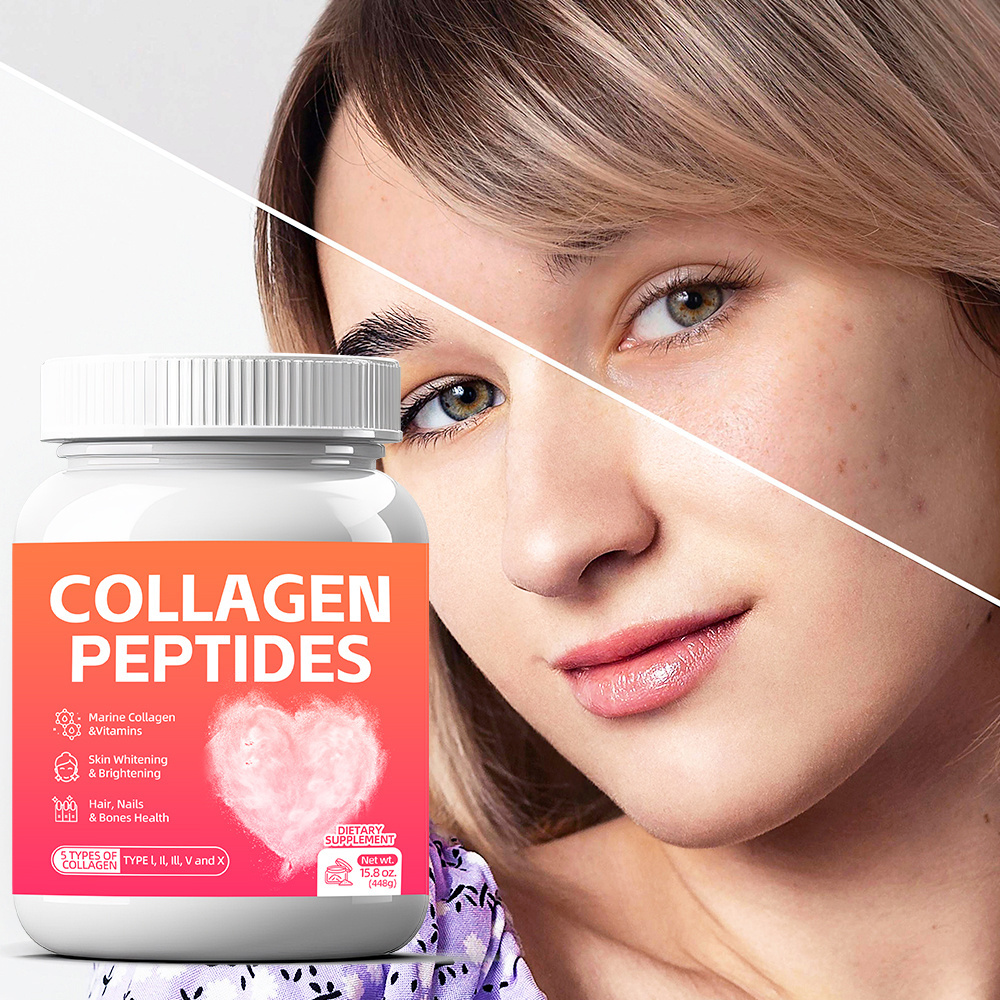 OEM/ODM Collagen Peptides Powder Drink Marine Fish Halal Skin-Whitening Collagen Anti Aging Supplement