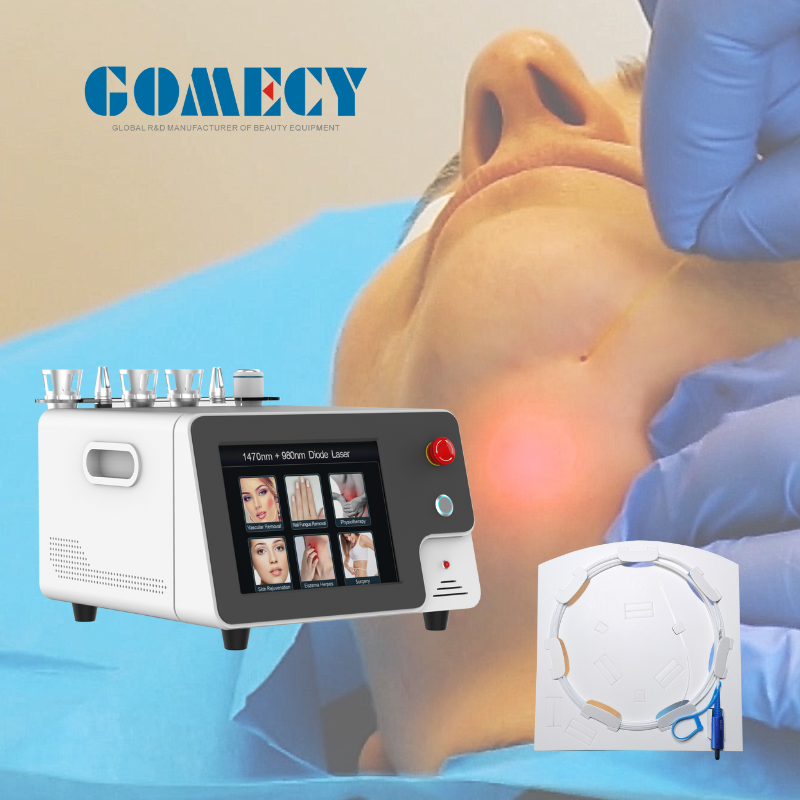 2023 gomecy  980nm&1470m diode laser 980nm laser ce medical device laser 980nm  beauty machine