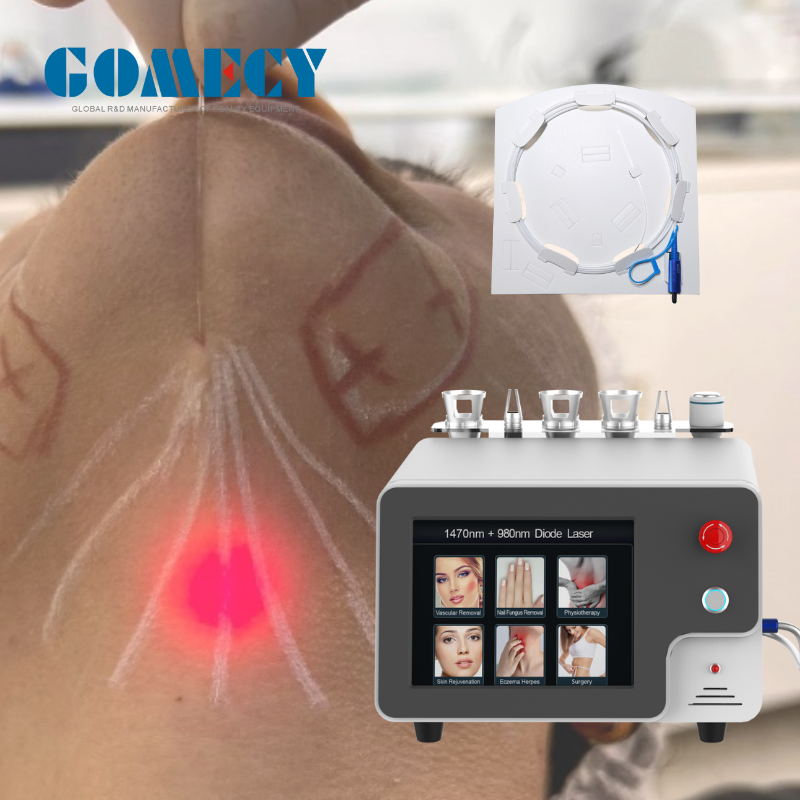 2023 gomecy  980nm&1470m diode laser 980nm laser ce medical device laser 980nm  beauty machine