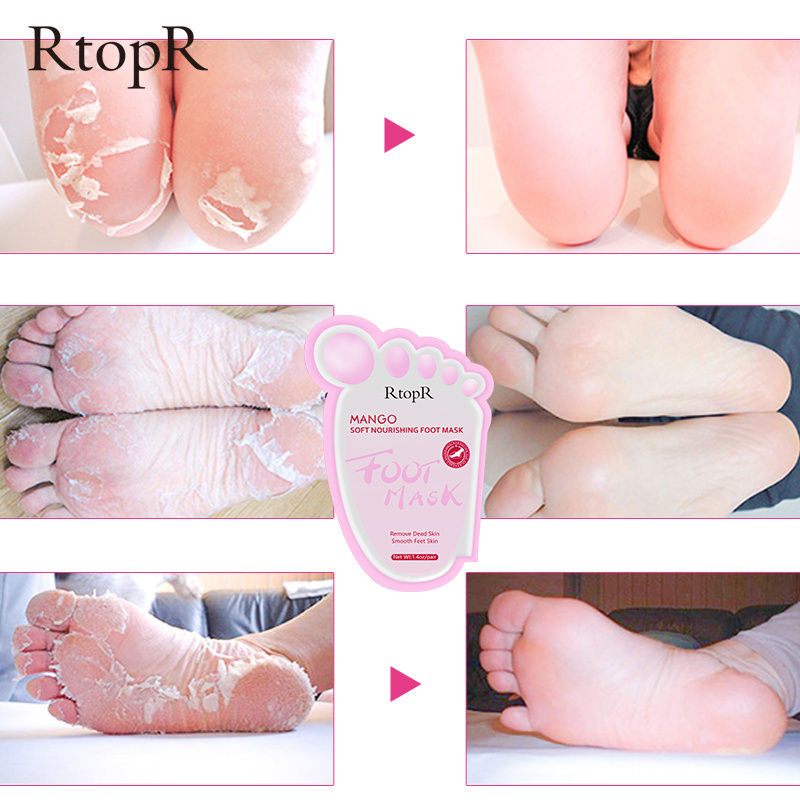 Foot Peeling Mask Pedicure Socks Peeling Scrub Remove Dead Skin Heel Foot Peeling Anti Cracking Foot Skin Care Treatment