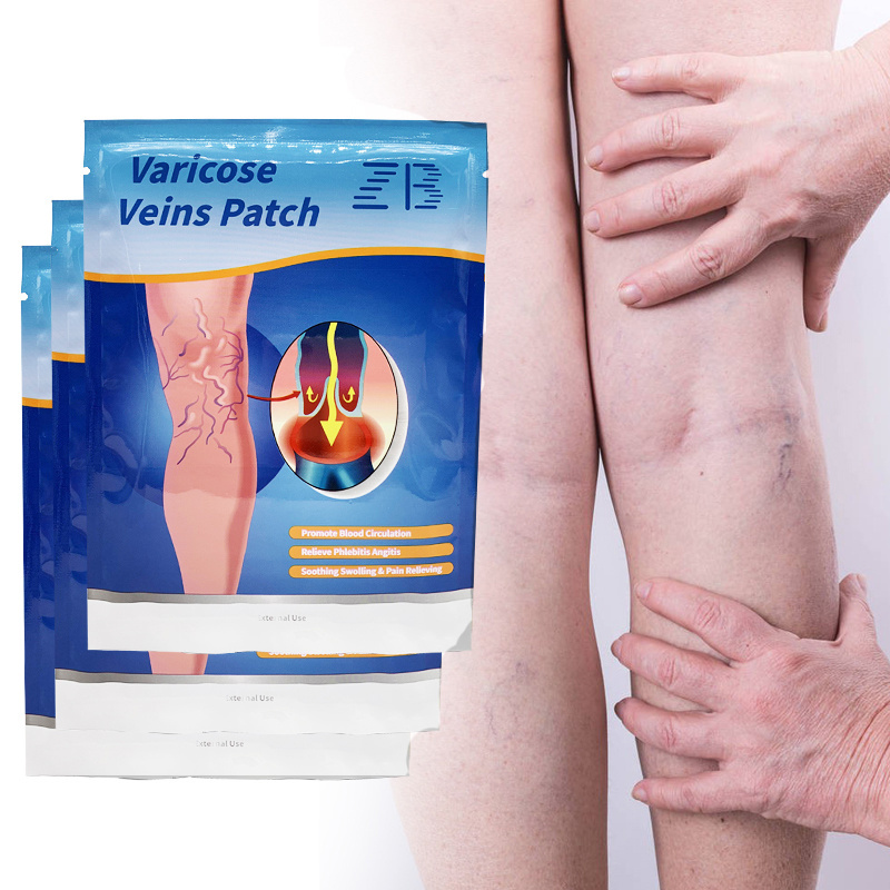 ZB Varicose Veins Plaster Chinese Medical Patch Vasculitis Phlebitis Spider Leg Skin Care Angiitis Removal Patch 12PCS/BAG