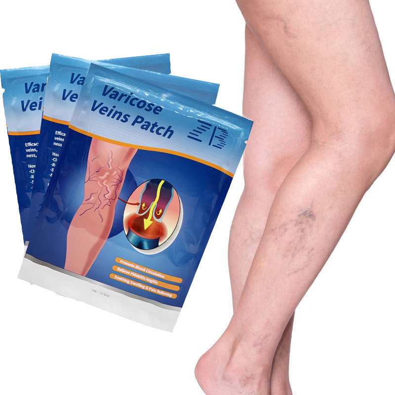 ZB Varicose Veins Plaster Chinese Medical Patch Vasculitis Phlebitis Spider Leg Skin Care Angiitis Removal Patch 12PCS/BAG