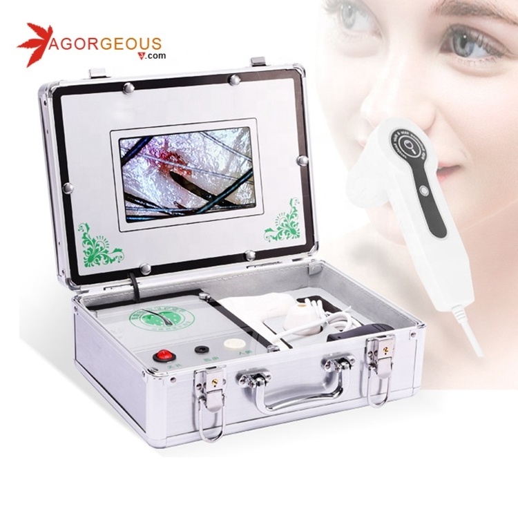 Mobile smart hair analysis machine /scalp and hair analyzer /skin and hair test machine skin and hair testing mineral machine