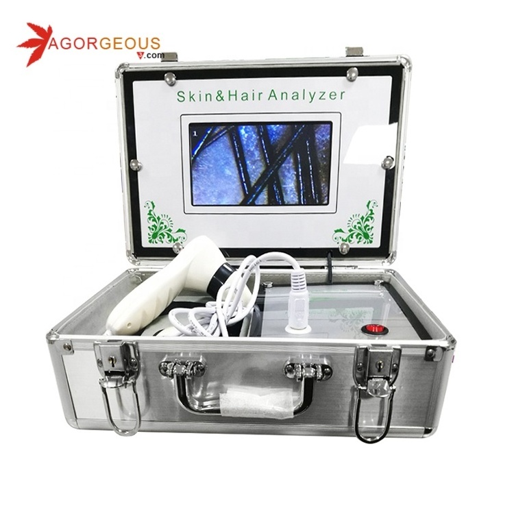 Mobile smart hair analysis machine /scalp and hair analyzer /skin and hair test machine skin and hair testing mineral machine