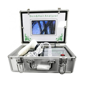 Mobile smart hair analysis machine /scalp and hair analyzer /skin and hair test machine skin and hair testing mineral machine