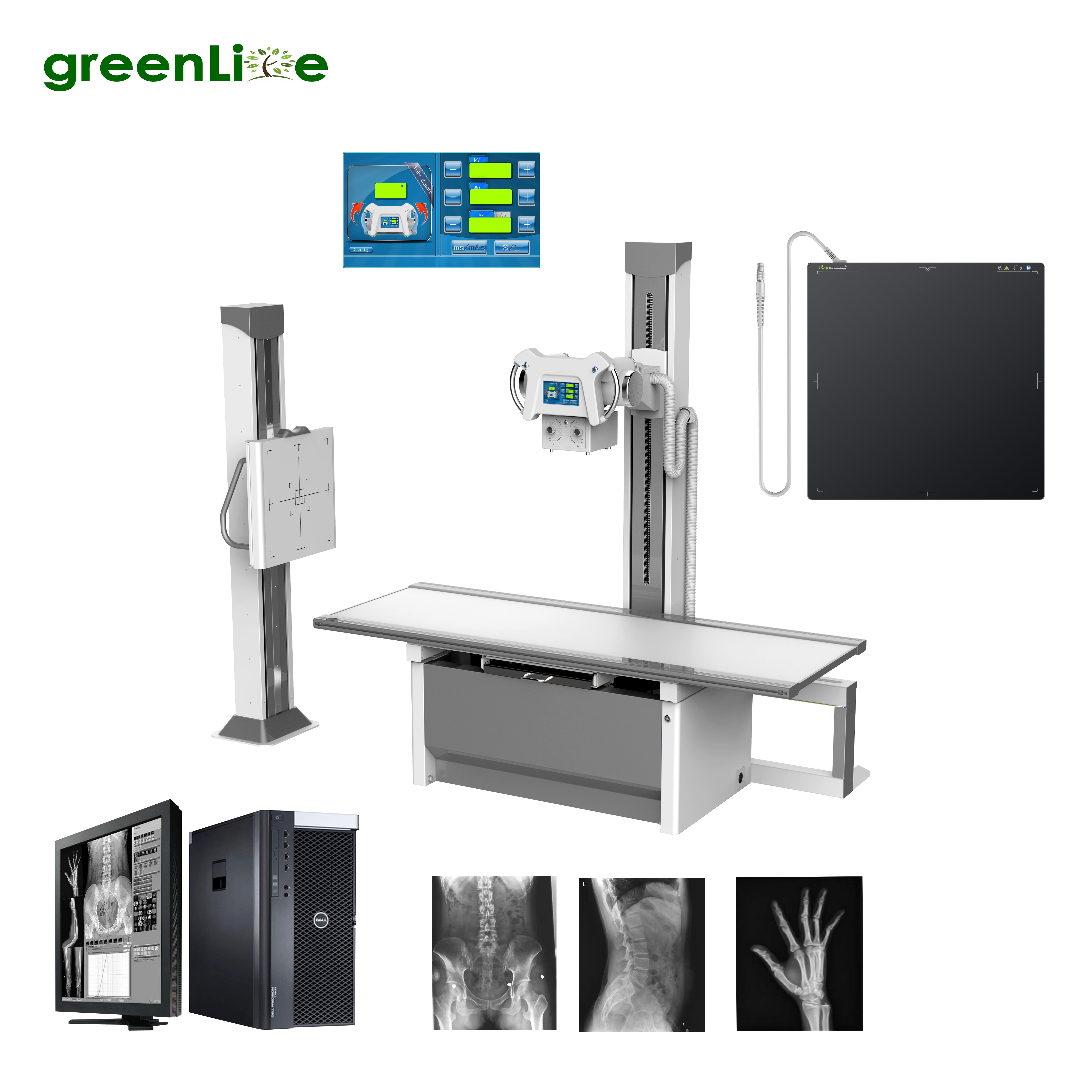 DR-F400 mA Radiography 32KW Medical DR Xray machine hospital Digital X Ray Diagnostic system Stationary cr X-ray Machine Price