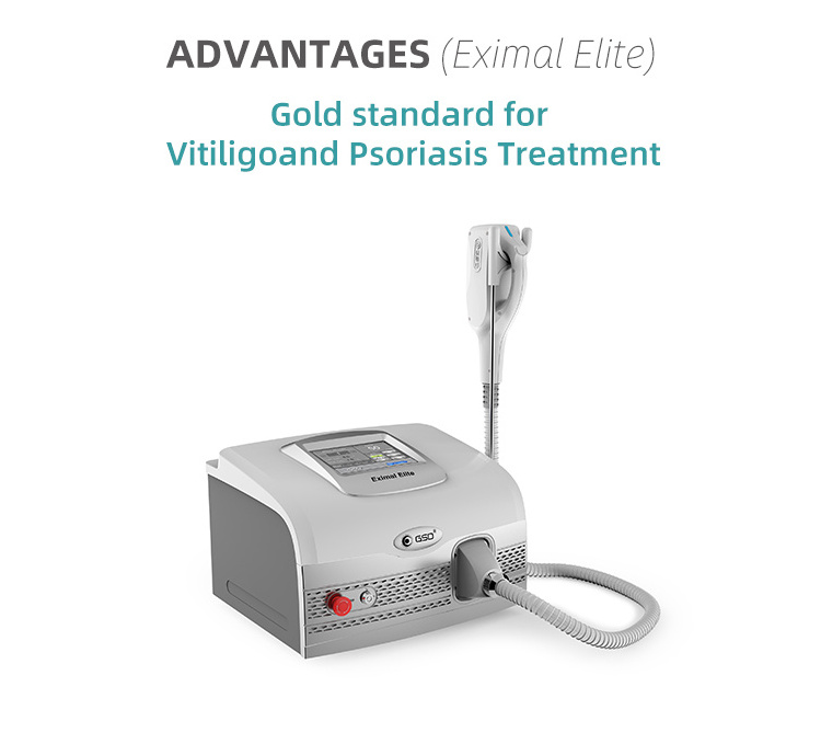 GSD 308nm Excimer Laser Vitiligo Phototherapy Home Medical Uv Treatment Instrument 308 Excimer Laser