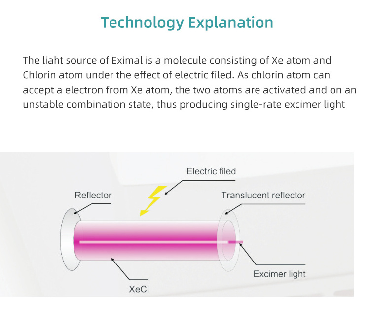 GSD 308nm Excimer Laser Vitiligo Phototherapy Home Medical Uv Treatment Instrument 308 Excimer Laser