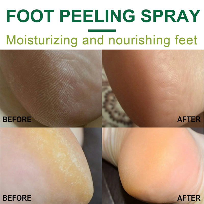 Private Label foot skin care Remove Dead Skin Foot Moisturizing Hydrating Nourish Peel green tea Orange Oil Foot Peeling Spray