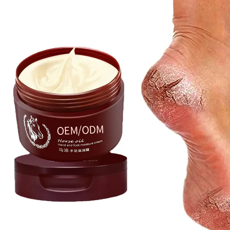 Private Label Exfoliator Feel Gel Moisturize Colossal Foot Rasp Foot File And Callus Remover Foot Peeling Cream For Cracked Heel