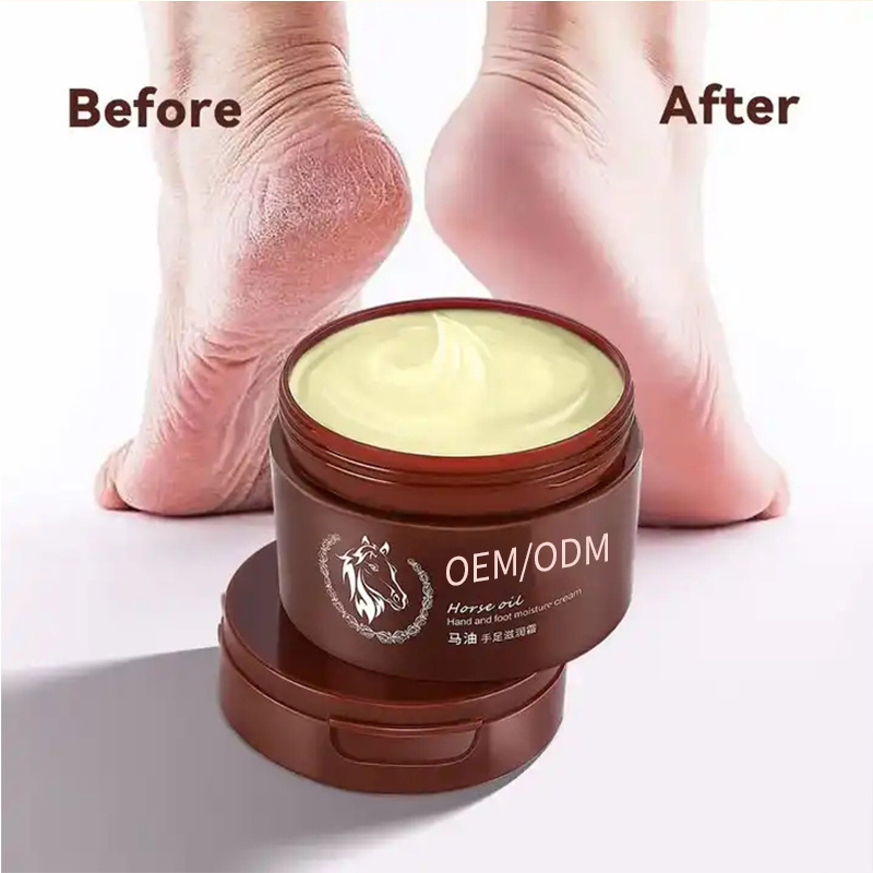 Private Label Exfoliator Feel Gel Moisturize Colossal Foot Rasp Foot File And Callus Remover Foot Peeling Cream For Cracked Heel