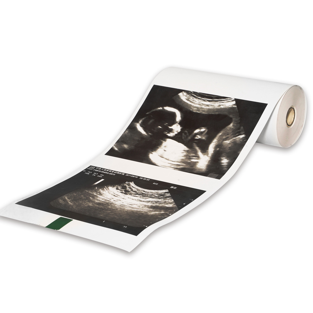 factory sale Medical record paper Custom size 110mm ID x 20m L 110S ultrasound paper suitable for hospital