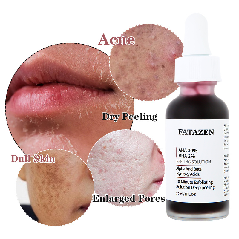 FATAZEN Salicylic Acid 2% Solution AHA 30% + BHA 2% Peel Solution Facial Acne Treatment Serum Essence For Face Exfoliating Serum