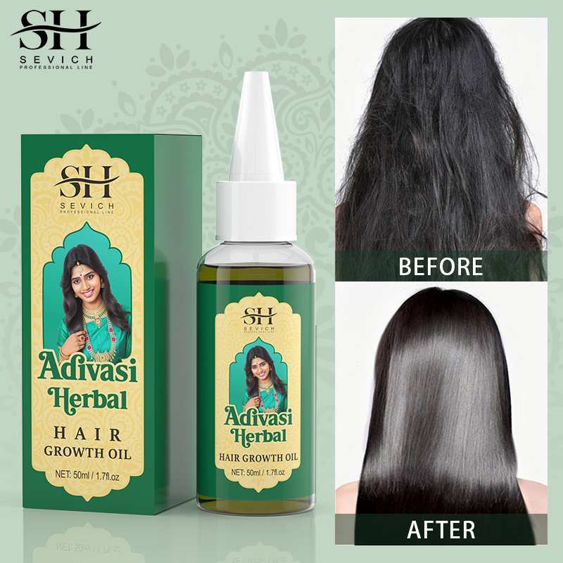 OEM Private Label Natural Adivasi Indian Herbal Hair Growth Oil Anti Loss Hair Treatment Growth Oil For Hair