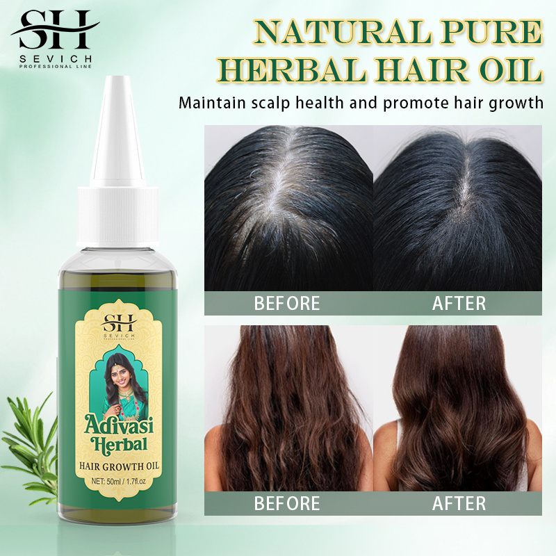 OEM Private Label Natural Adivasi Indian Herbal Hair Growth Oil Anti Loss Hair Treatment Growth Oil For Hair