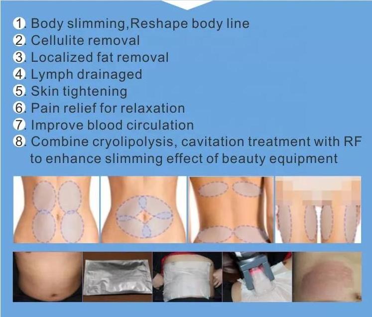 Fat cryo lipolysis Cell Body 360 Cryolipolysis Machine Vacuum Cavitation System Except Cryolipolysis Slimming Machine