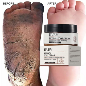 Retinol Foot Care Cream Ror Cracked Heels Exfoliating Anti Crack Peeling Dead Skin Removal Foot Repair Whitening Foot Cream