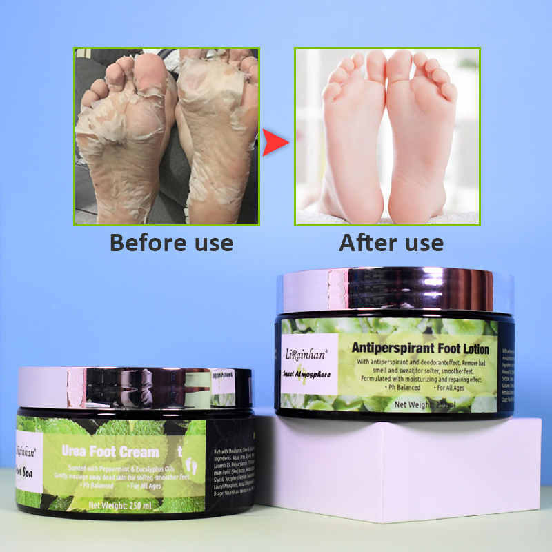 Foot Cream Suitable For Cracked Heel Knee Elbow Hand Repair Moisturizer Turmeric Callus Dead Skin Remover Nail Softener