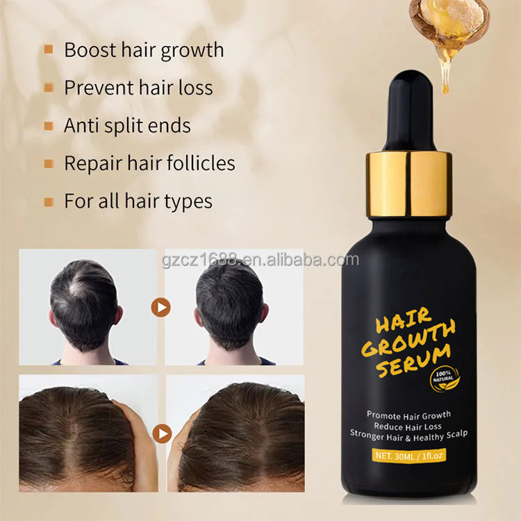 Hair Growth Serum Oil Biotin Regrowth Treatment for Scalp Hair Loss Thinning Hair Growth Serum for Men Women