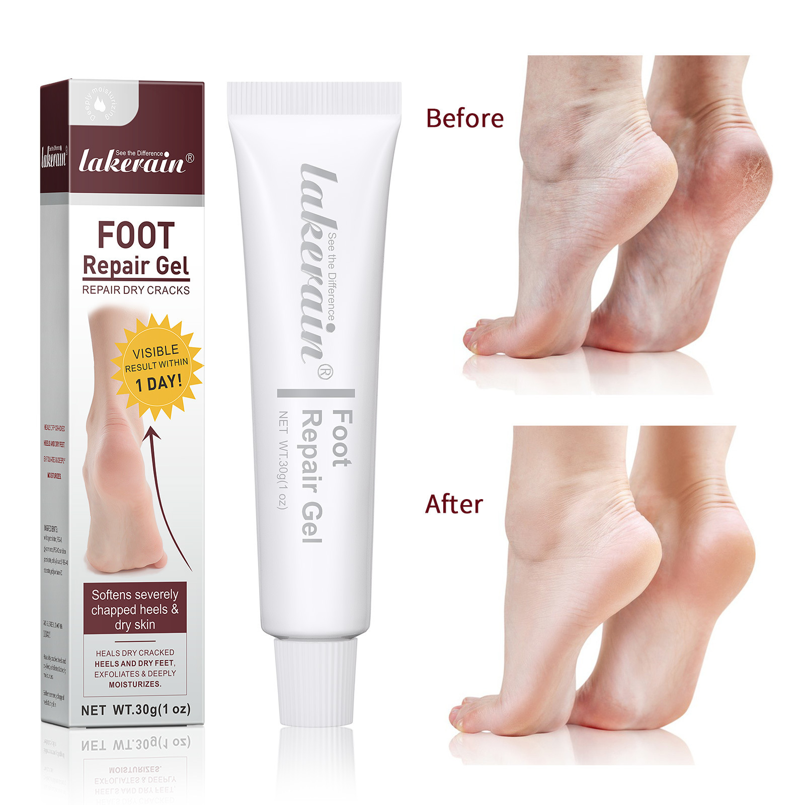 Anti dry chapping crack foot skin care products nourish cracked heels anti-cracking moisturizing exfoliating foot repair gel