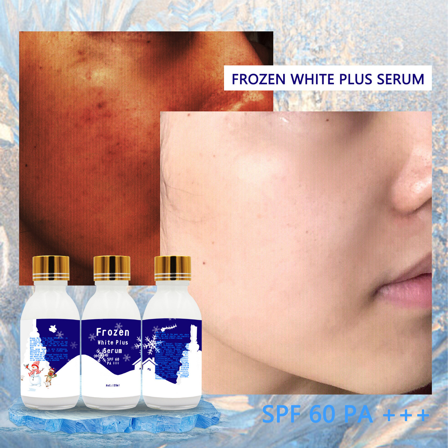 Beauty Products Frozen Skin Moisturizing Whitening SPF 60 Shower Gel Cream Serum Lotion Shower Foam Set For Men And Woman