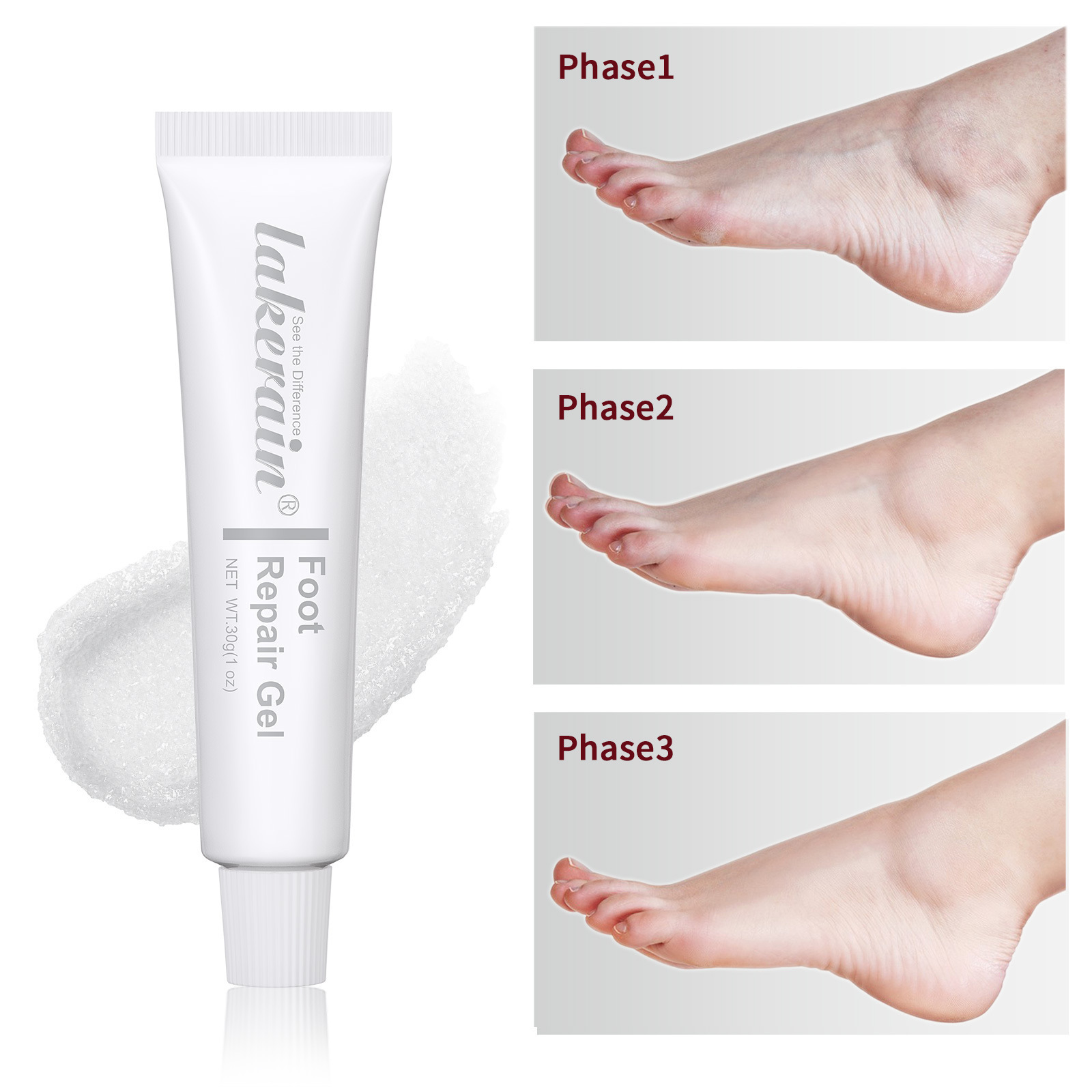 Anti dry chapping crack foot skin care products nourish cracked heels anti-cracking moisturizing exfoliating foot repair gel