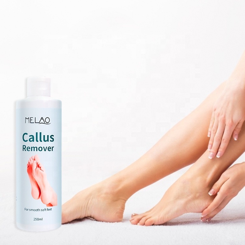 Gentle Removal Calluses Wholesale Foot Care Whitening Gel File Callus Remover Peel