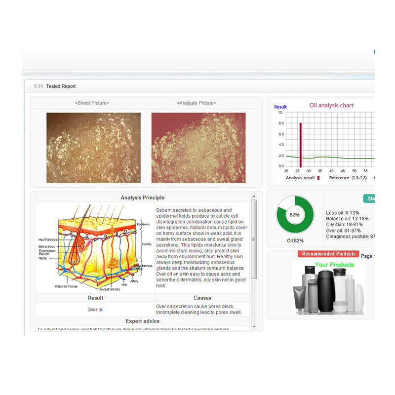 USB connective with report and before after compare 3d visia skin analysis machine for beauty salon and cosmetics chains