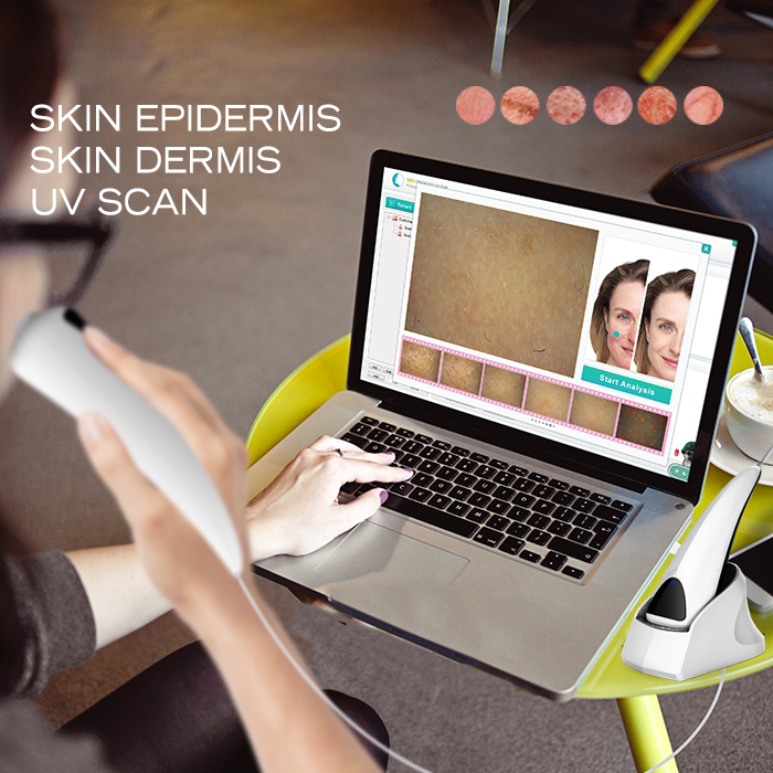 USB connective with report and before after compare 3d visia skin analysis machine for beauty salon and cosmetics chains