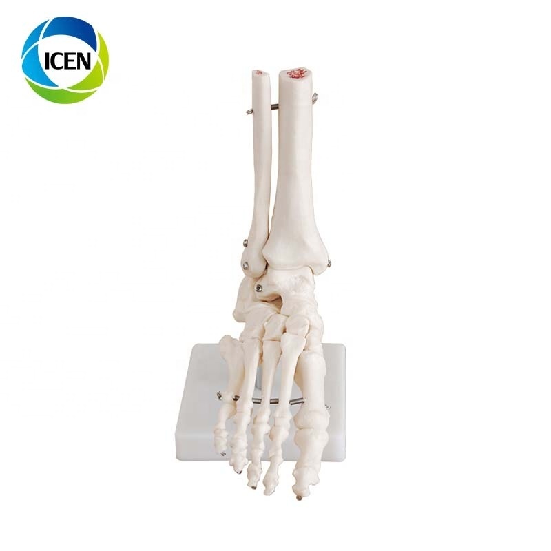 IN-104 human simulation skeleton model shoulder joint model with ligament