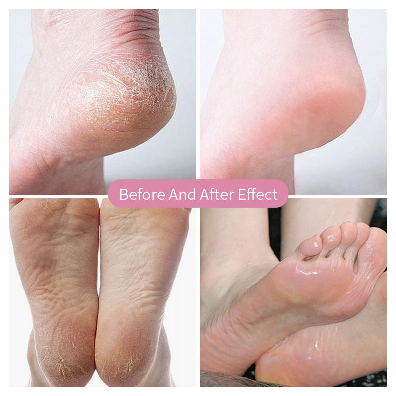 OEM Private Label Natural Herbal Foot Skin Care Moisturizing Exfoliating Peeling Off Foot Mask