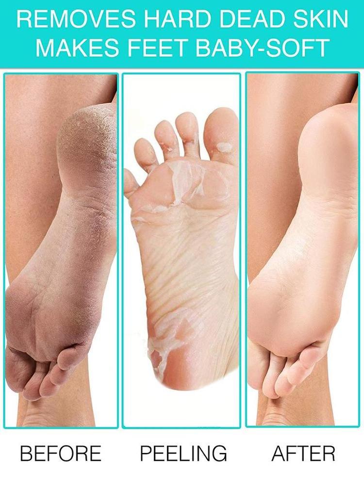 Private Label Improved Formula Baby Soft Feet Exfoliating Foot Peel Mask