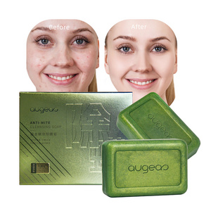 Guangzhou factory skin care whitening best anti acne soap for face