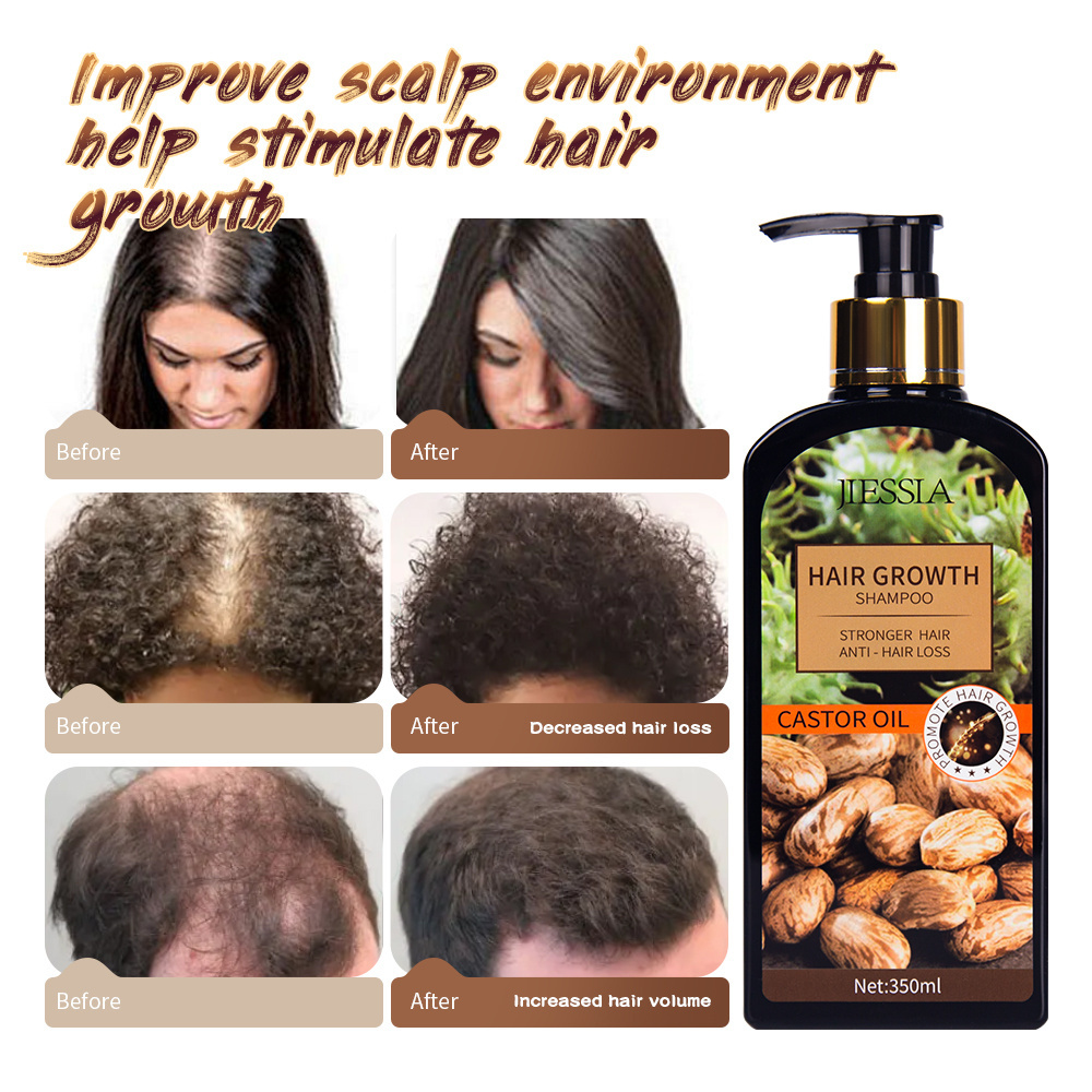 350ml castor oil long hair growth shampoo