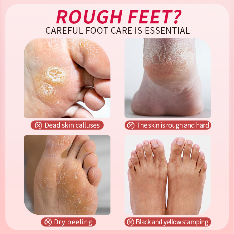 Rejuvenating the skin exfoliating foot mask by manufacturer wholesale korea callus removal foot peel mask sock foot mask logo