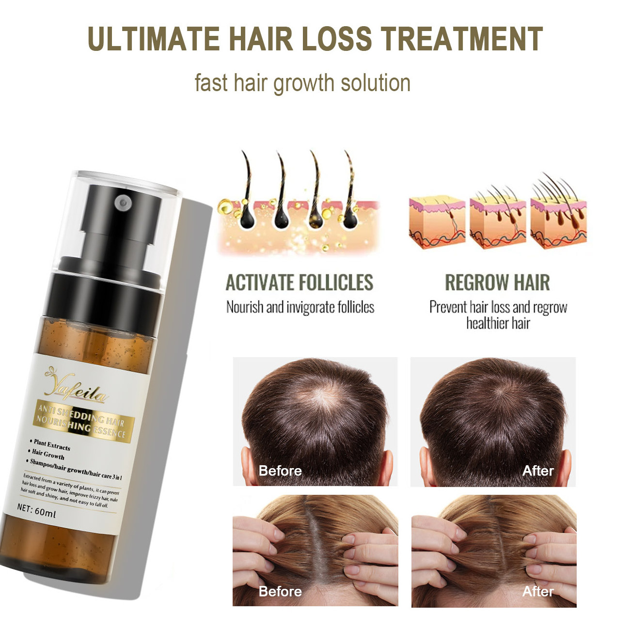 OEM Hair lotion scalp treatment products cps coconut keratin regrowth anti-loss oil treatments for hair growth,men and women