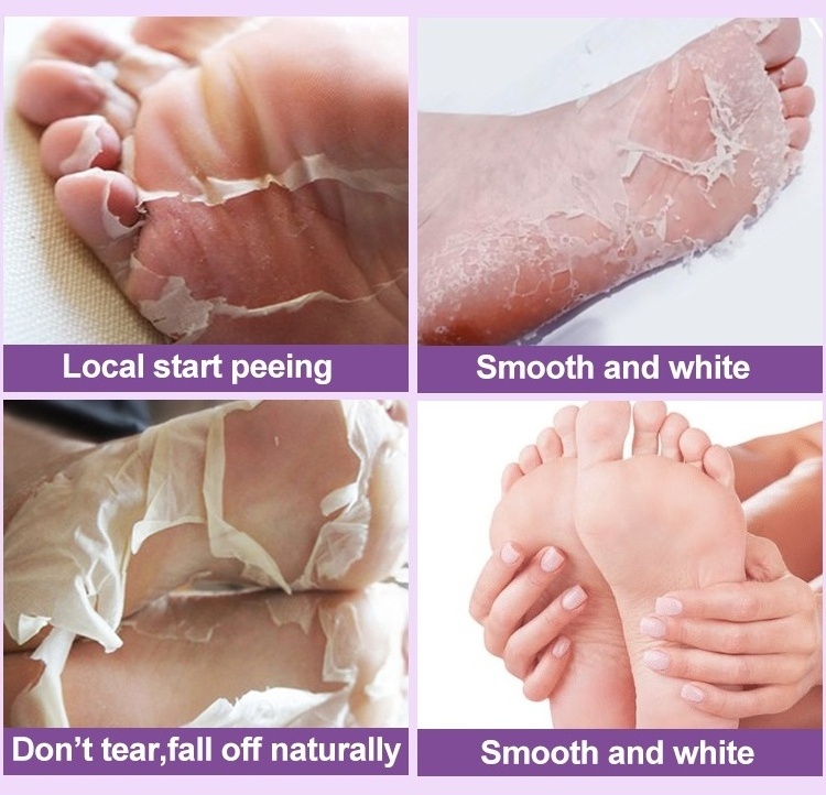 Feet peeling baby your foot skin care mask products foot peel mask for exfoliating peeling the foots men baby soft feet