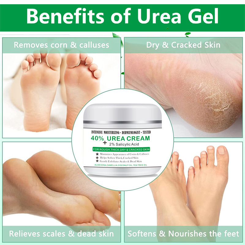 Urea 40% Cream Oil Anti-Drying Crack Foot Cream  Removal Dead Skin Hand Feet Care 100g Heel Cracked Repair Cream