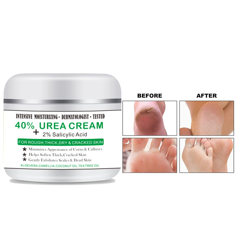 Urea 40% Cream Oil Anti-Drying Crack Foot Cream  Removal Dead Skin Hand Feet Care 100g Heel Cracked Repair Cream