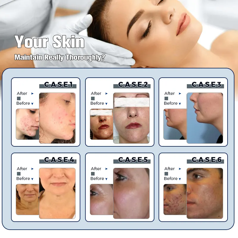 Beauty products hydro machines hydra oxygen facial microdermabrasion diamond dermabrasion glow machine rf spa equipment