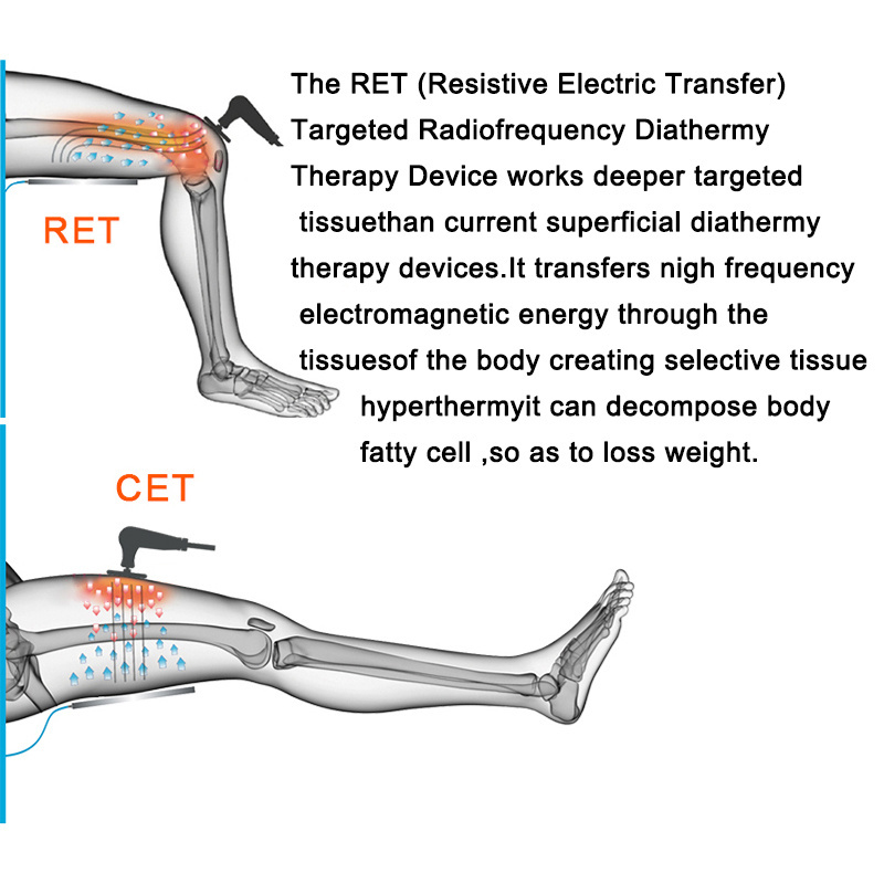 Radialfrequency RF physiotherapy CET and RET tecar therapy diathermy machine for physiotherapy and beauty skin tightening