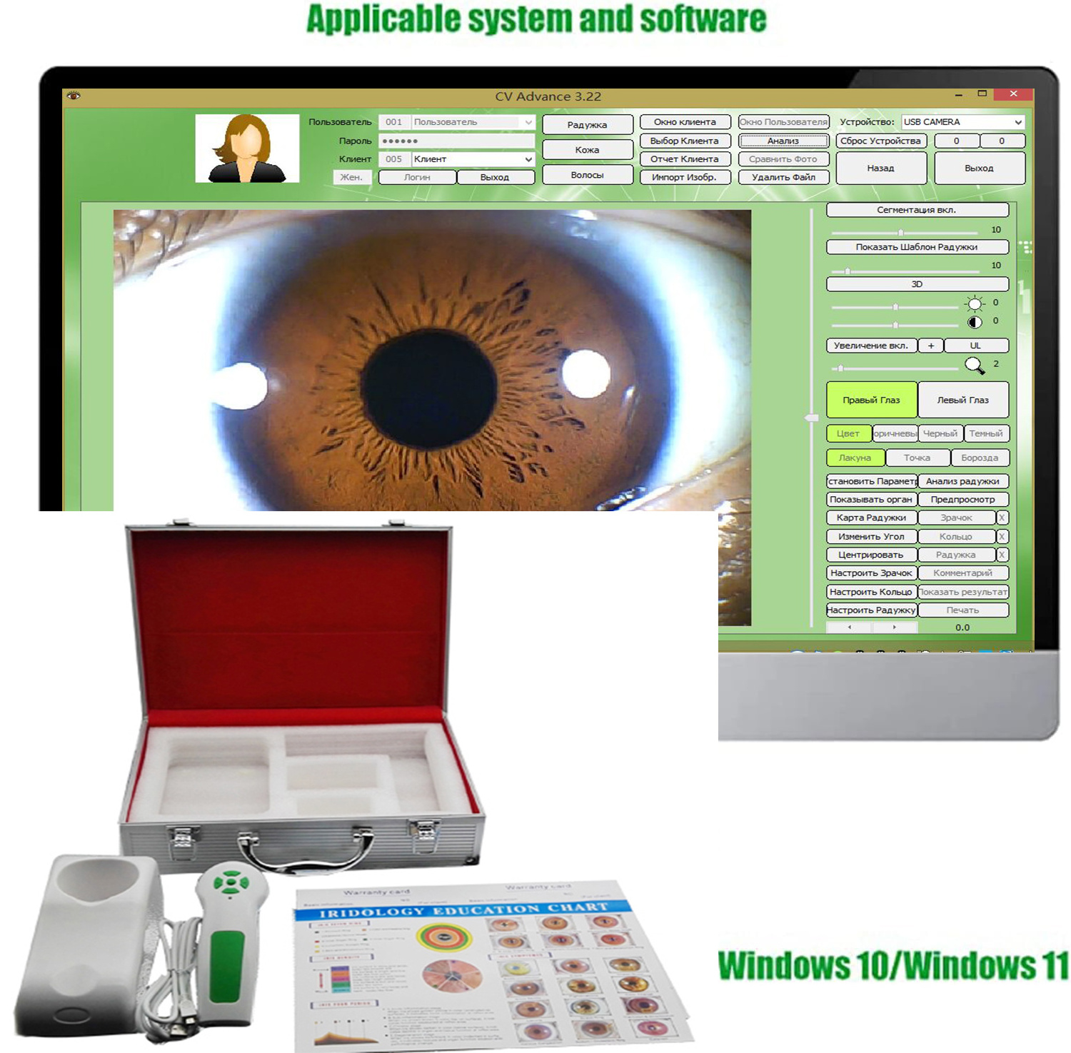 12 Million Pixel HD 30x Iris Lens and Driver-Free Analysis Software Iris Detector Auto Focus Iriscope Analyzer