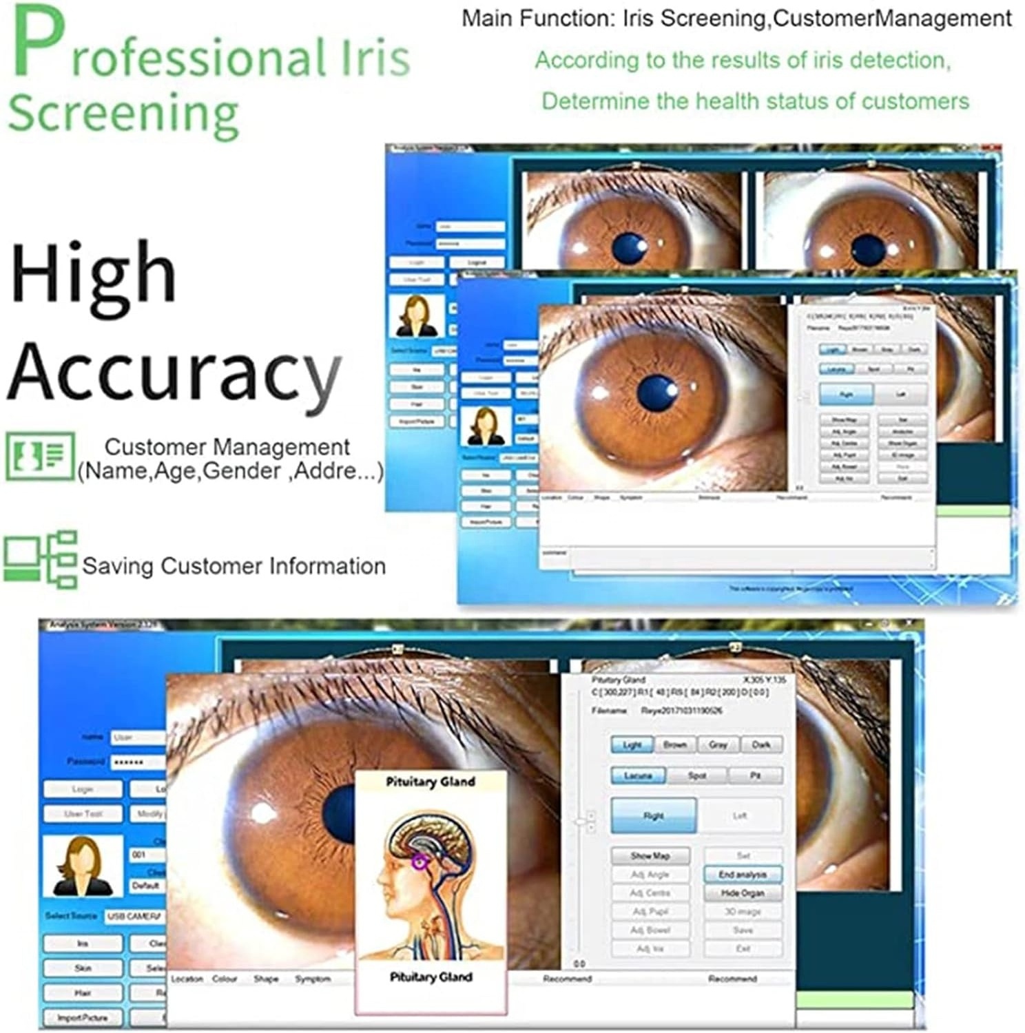 12 Million Pixel HD 30x Iris Lens and Driver-Free Analysis Software Iris Detector Auto Focus Iriscope Analyzer