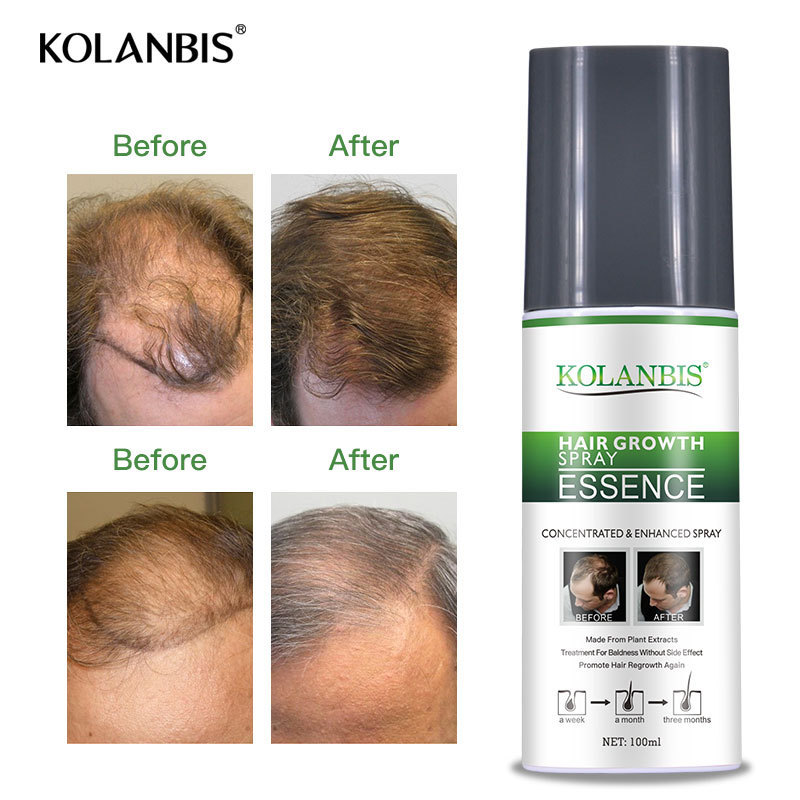 KOLANBIS organic 100% natural products hair growth fluid sale for raw material make hair regrowth 100ml