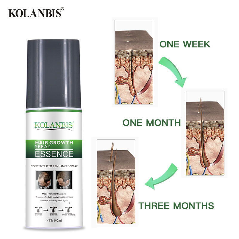 KOLANBIS organic 100% natural products hair growth fluid sale for raw material make hair regrowth 100ml